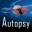 Autopsy 4.21